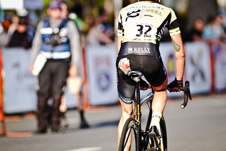 Road rash can ruin a cyclist's ride. Learn the essentials of prevention, treatment, and recovery from road rash injuries.